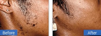 Client before and after result